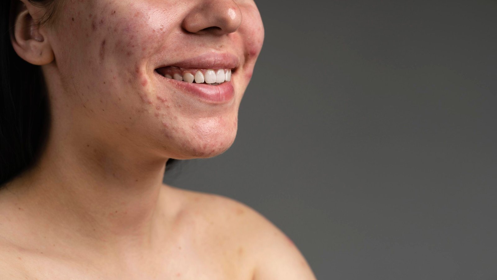 6 Étapes pour un Soin Visage Peau Grasse Efficace et Équilibré