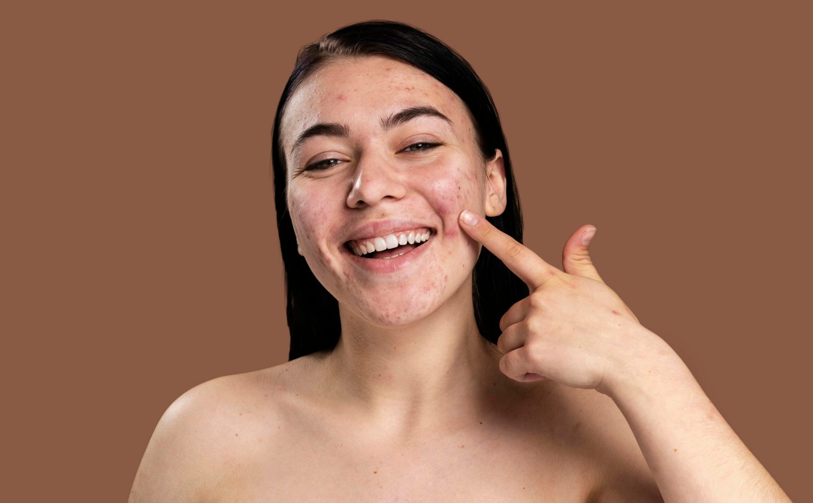 Conseils pour Choisir la Meilleure Crème Solaire Peau Grasse Cet Été 2025